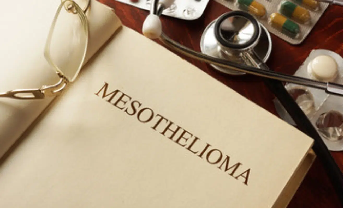 Open book with 'MESOTHELIOMA' title